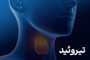 تیروئید