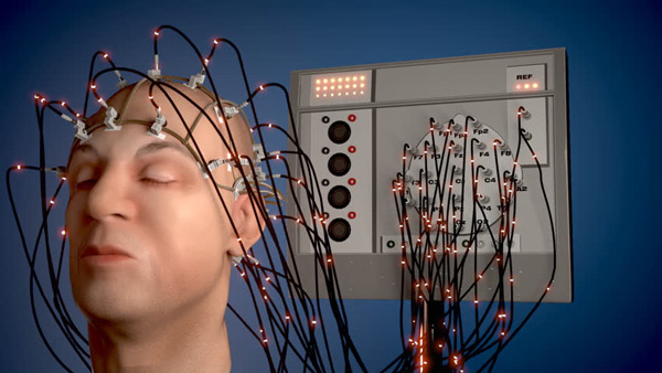 الكترو انسفالو گرام(EEG)